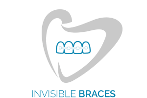 Invisible Braces horizontal button at Orthodontic Specialist PC in Brooklyn Staten Island NY and Metuchen NJ